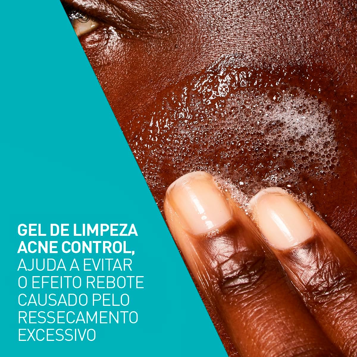 Cerave, Gel de Limpeza Acne Control com Niacinamida e Ácido Salicílico, 340g - Image 6